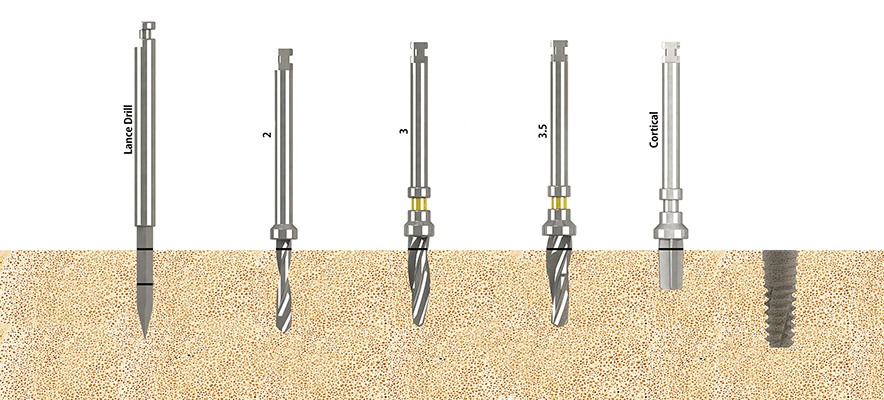 SLV Implants Systems- Premium Mini Implant