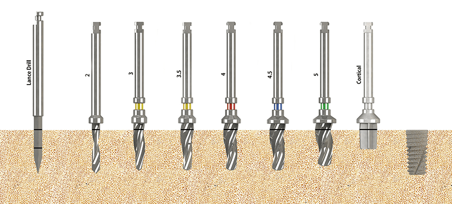 SLV Implants Systems- Premium Standard Implant Cap 5